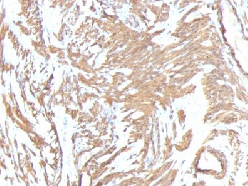 Actin, Smooth Muscle (Leiomyosarcoma Marker) Antibody