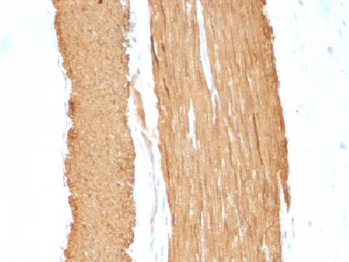 Actin, Smooth Muscle (Leiomyosarcoma Marker) Antibody
