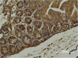 ACTA2 Antibody