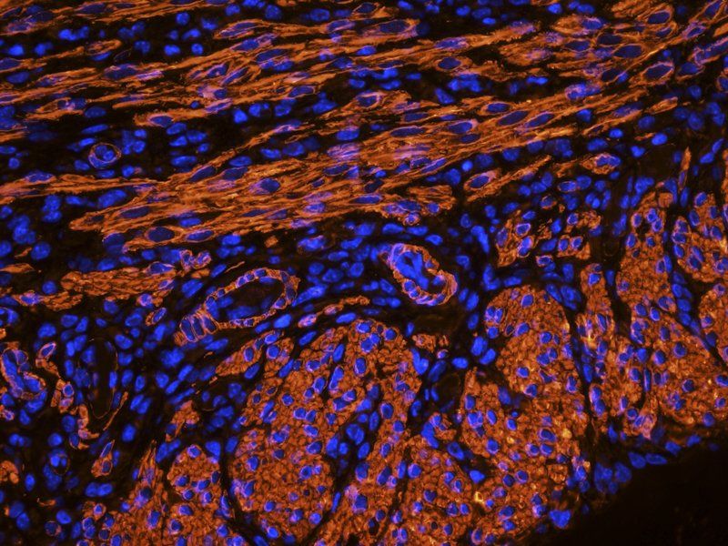 ACTA2 antibody