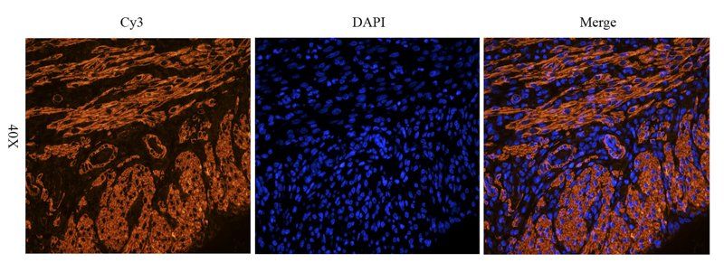 ACTA2 antibody