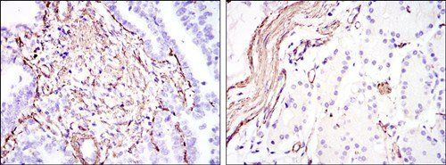 ACTA2 Antibody