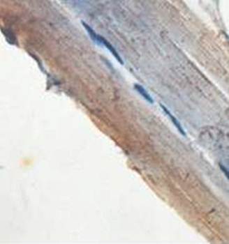 ACTA2 Rabbit Polyclonal Antibody