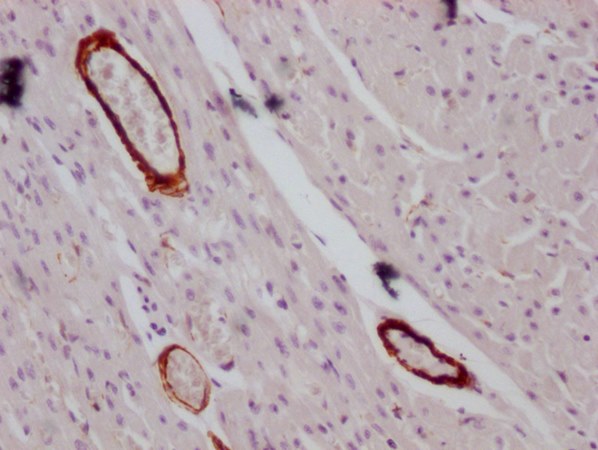ACTA2/ACTG2 Antibody