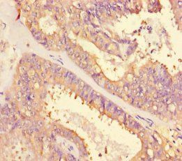 ACTB Antibody