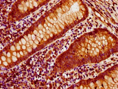 ACTB Antibody