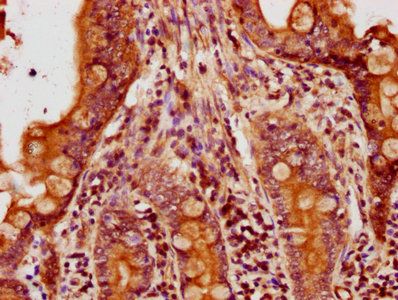 ACTB Antibody