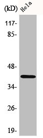 ACTB/POTEKP/ACTG1 Antibody