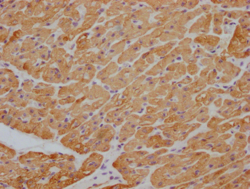 ACTB/POTEKP/ACTG1 Monoclonal Antibody