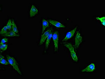 ACTG1 Antibody
