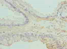 ACTG2 Antibody
