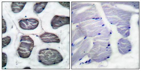 Actin-α-1 Antibody