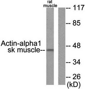 Actin-α-1 Antibody