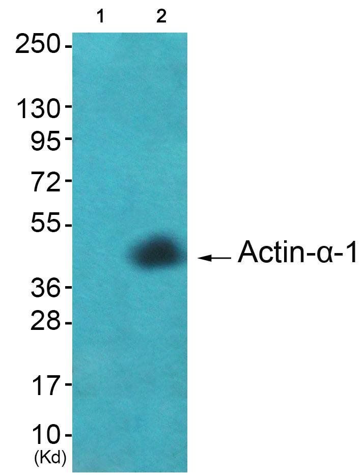 Actin-α-1 Antibody