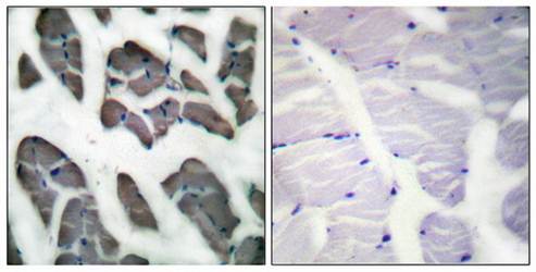 Actin-γ2 Antibody