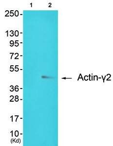 Actin-gamma2 antibody