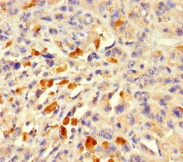 Actin-like protein 7A antibody