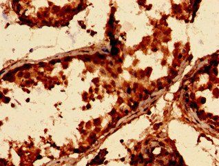 Actin-related protein 2/3 complex subunit 3 antibody