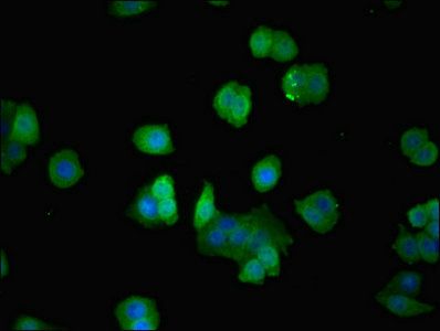 Actin-related protein 2/3 complex subunit 3 antibody