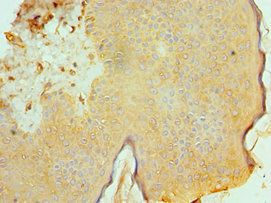 ACTL6B Antibody