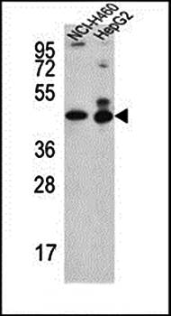 ACTL6B antibody