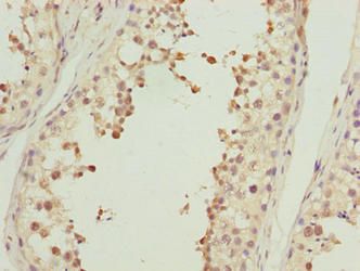 ACTL7B antibody