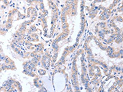 ACTL8 Antibody