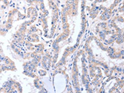 ACTL8 antibody