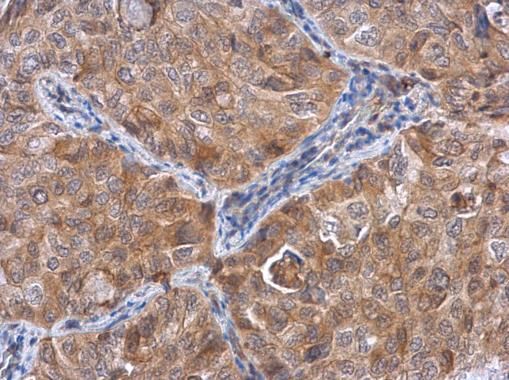 ACTL8 antibody