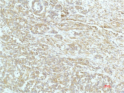 ACTN1 Monoclonal Antibody
