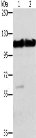ACTN2 antibody