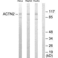 ACTN2 antibody