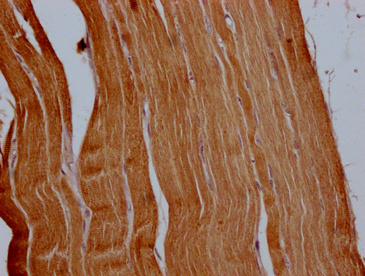 ACTN2 Antibody