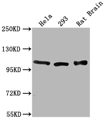 ACTN2 Antibody