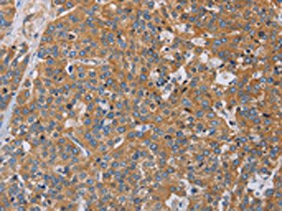 ACTN4 Antibody