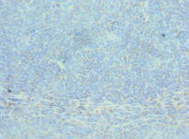 ACTR2 Antibody