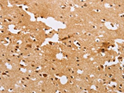 ACTR2 Antibody