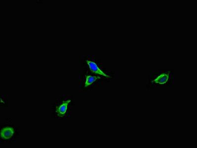 ACTR3 antibody