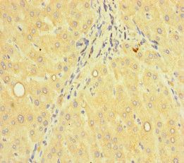 ACTR5 Antibody