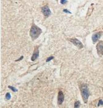 ACTR6 Rabbit Polyclonal Antibody