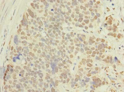 ACTRT1 Antibody