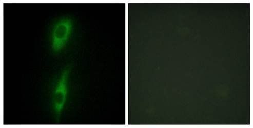 ACVL1 Antibody