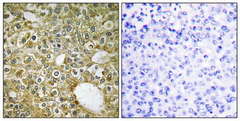 ACVL1 Antibody