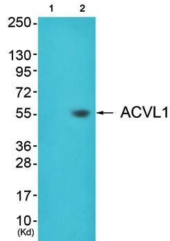 ACVL1 Antibody