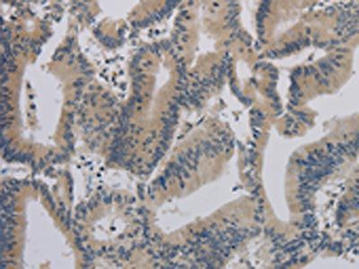 ACVR1B Antibody