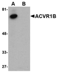 ACVR1B Rabbit Polyclonal Antibody