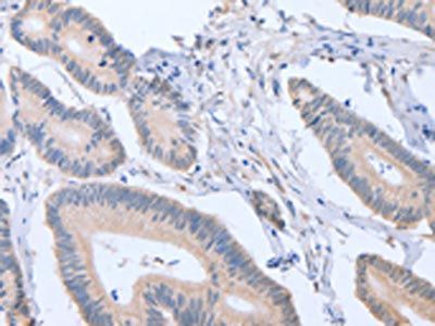 ACVR1C Antibody