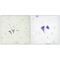 ACVR1C Antibody