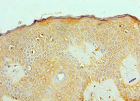 ACVR2A Antibody