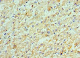ACVR2A Antibody